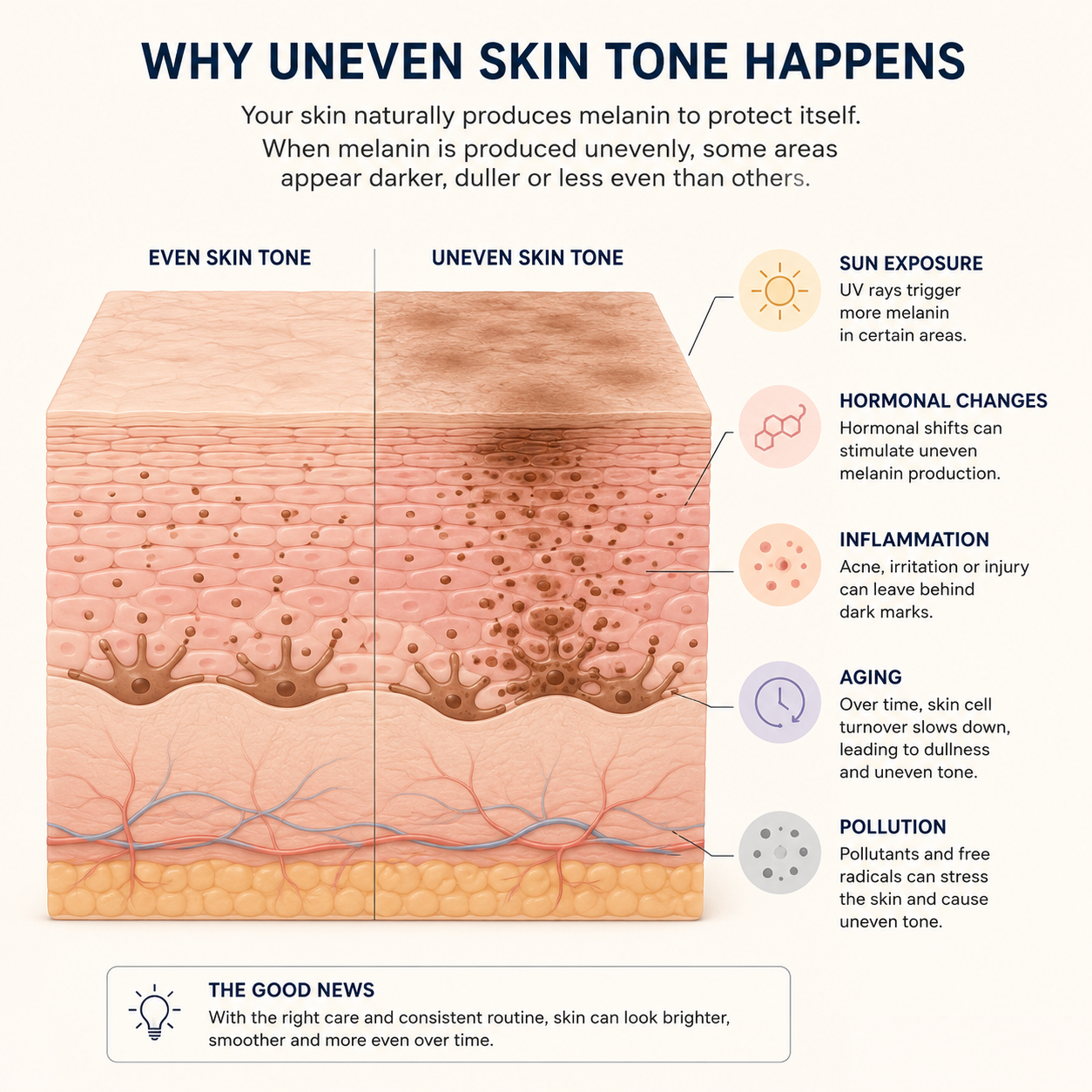 Simple diagram explaining why uneven skin tone happens